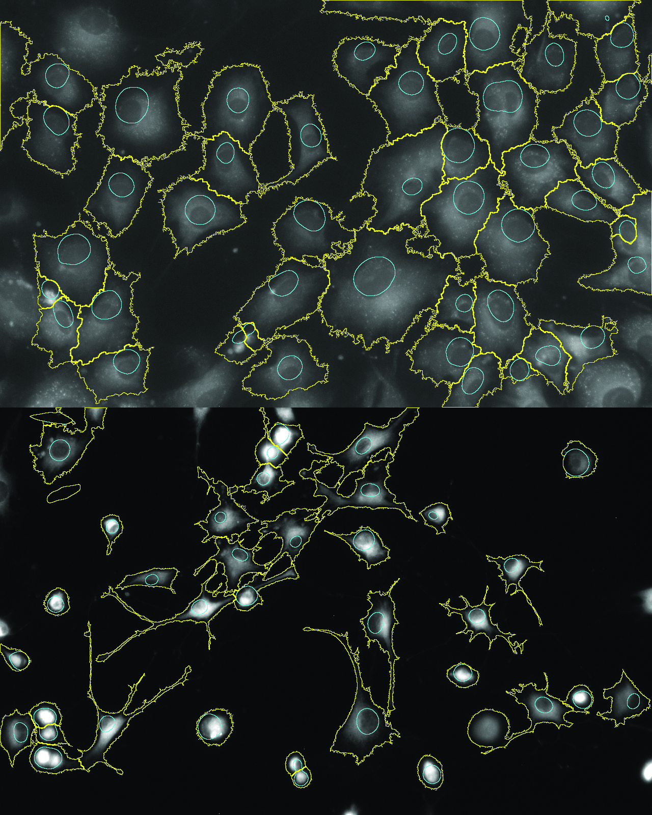 Fluorescence microscopy images showing segmented cells with outlined cell boundaries and nuclei used for automated cell morphology analysis.