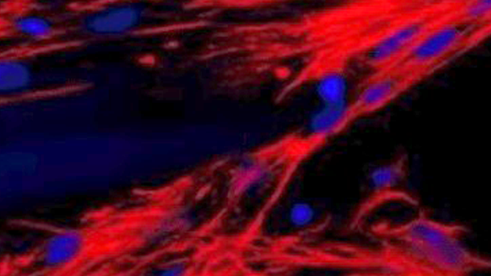 cell fibers magnified